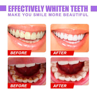 Witee™ Teeth Colour Corrector Serum