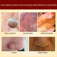 MaskMagic™ Pro-Herbal Refining Peel-Off Facial Mask