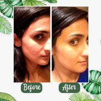 Grengluu™ Natural Green Tea Mask