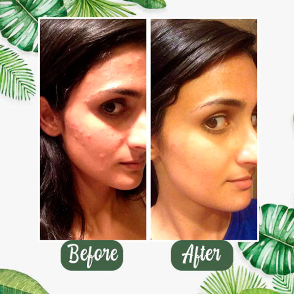 MagicGreen™ Natural Herbal Mask