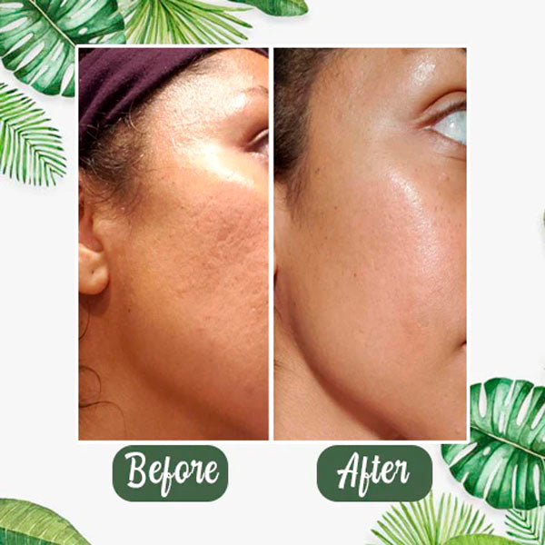 Greenglu™ Natural Green Tea Mask