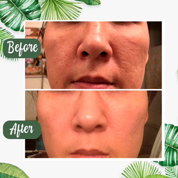 [Special Offer] Get Extra MagicGreen™ Natural Green Tea Mask at 65% OFF
